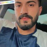 کاشت ابرو مو ریش|خدمات آرایشگری و زیبایی|گرگان, |دیوار