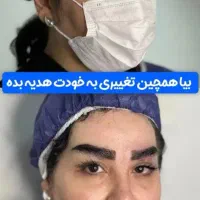 کاشت مو وزیبایی بدن اقساطی|خدمات آرایشگری و زیبایی|تبریز, |دیوار