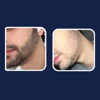 ریش ۱۷|آرایشی، بهداشتی، درمانی|بانه, |دیوار