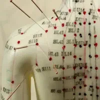 طب سوزنی و کایروپراکتیک،فصد،ح / درمان دردهای مزمن