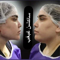 مرکز تخصصی ساکشن غبغب بوکال فت بلفارو کاشت ابرو|خدمات آرایشگری و زیبایی|تهران, پونک|دیوار