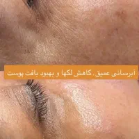 پوست زیبا و براق|خدمات آرایشگری و زیبایی|اردبیل, |دیوار