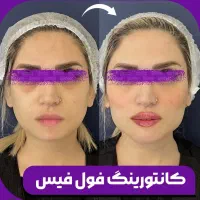 استخدام اوپراتور لیزر و منشی مسلط به تزریقات سرم