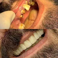 لبخندت رو با اقساط تا 12 ماهه بساز‌