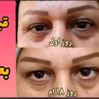 محصولات بهداشتی مراقبتی همراه با مشاوره