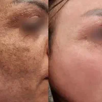 ارایشی|آرایشی، بهداشتی، درمانی|بندرعباس, |دیوار