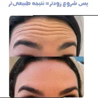 کلینیک لیزر و زیبایی موریزان