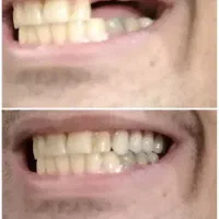 ت خفیف ویژه در طرح به زیبایی لبخند|آرایشی، بهداشتی، درمانی|یزد, |دیوار