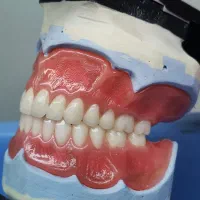 دندان مصنوعی ایتالیایی|آرایشی، بهداشتی، درمانی|چناران, |دیوار