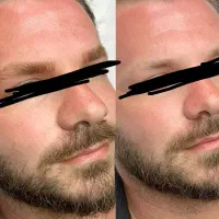 رفع نواقص ابرو در اقایان/میکرو /لیفت ابرو|خدمات زیبایی و سلامت|تبریز, |دیوار