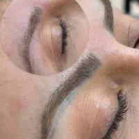 تخفیف 10 درصدی پاک کردن تتو ابرو خانم ها با لیزر