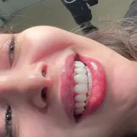 کامپوزیت دندان|خدمات آرایشگری و زیبایی|بوشهر, |دیوار