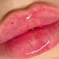 اموزش ویژه ژل و بوتاکس|خدمات آرایشگری و زیبایی|اصفهان, جامی|دیوار