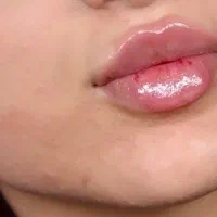 جنشنواره افتتاحیه کلینیک تخصصی لب