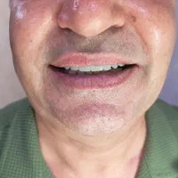 لابراتوار دندان مصنوعی|خدمات آرایشگری و زیبایی|جم, |دیوار