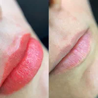 مدل میکروبلیدینگ فیبروز شیدینگ لب خط چشم ریموو