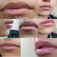 خدمات ژل لب.فیلر‌صورت،پیرسینک،چالگونه