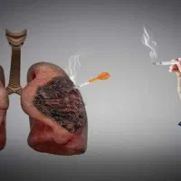 ترک اعتیاد تضمینی