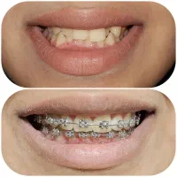 ارتودنسی تخصصی/دندان پزشکی
