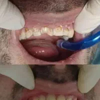 جشنواره تخفیفات تابستانه دندانپزشکی استان کرمانشاه