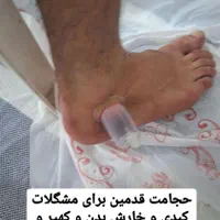 حجامت و زالو درمانی و بادکش ب صورت تخصصی