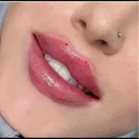 جشنواره یلدایی ویژه فیلر هرسیسی ۶۹۰