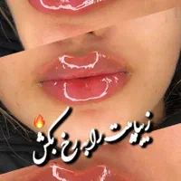 تزریق واموزش ژل بوتاکس مزوتراپی لیفت نخ...|خدمات آرایشگری و زیبایی|کرمانشاه, |دیوار
