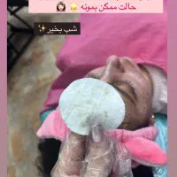 مدل فیشیال vipزیرنظرپزشک