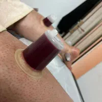 زالودرمانی / حجامت/ بادکش درمانگرآقاوخانم باسابقه|خدمات آرایشگری و زیبایی|مشهد, امام رضا (ع)|دیوار