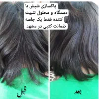 دستگاه شپش گیری/درمان شپش قطعی