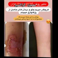 رشد مجدد موها فقط با محصولات طبیعی|آرایشی، بهداشتی، درمانی|فرمهین, |دیوار