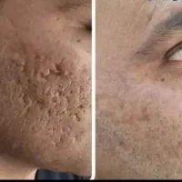 نیازمند مدل فقط۲۵۰ اقایان‌وخانم هادر کلینیک