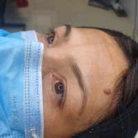 به یک مدل برای انجام کارفیبروز نیازمندیم|خدمات آرایشگری و زیبایی|تهران, سعادت‌آباد|دیوار