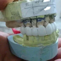 ساخت انواع دندان متحرک و ثابت|خدمات آرایشگری و زیبایی|اهواز, پادادشهر|دیوار