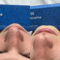 تزریق و آموزش ژل و بوتاکس|خدمات آرایشگری و زیبایی|تهران, مسعودیه|دیوار