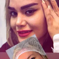 آفر میکروکاشت ابرو