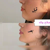 کلینیک پوست و زیبایی (تمام خدمات توسط پزشک)|خدمات آرایشگری و زیبایی|مشهد, کوه سنگی|دیوار