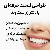 انجام خدمات زیبایی دندان