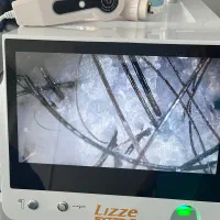 خدمات احیاو صافی و خدمات درمانی اسکراب اسکالپ|خدمات آرایشگری و زیبایی|نوشهر, |دیوار