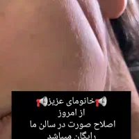 اصلاح صورت و ابرو رایگان درمبارک آباد