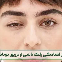 درمان افتادگی پلک ناشی از بوتاکس