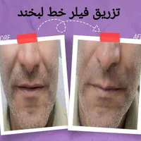 خدمات زیبایی جامع با بهترین کیفیت|خدمات آرایشگری و زیبایی|اصفهان, شاهزاده ابراهیم|دیوار
