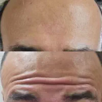 انجام امور زیبایی و تناسب اندام