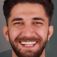 دندانپزشکی از دم قسط ایمپلنت کامپوزیت عصبکشی روکش|خدمات آرایشگری و زیبایی|خرمآباد, |دیوار