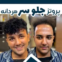 پروتزمو (دکترپروتز)|خدمات آرایشگری و زیبایی|اصفهان, هزارجریب|دیوار