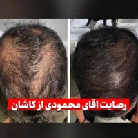 محلول گیاهی ضد ریزش مو و رویش مجدد|آرایشی، بهداشتی، درمانی|شیراز, بهارستان|دیوار