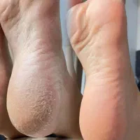 اسپا کف سابی|خدمات آرایشگری و زیبایی|شیراز, کوشک میدان|دیوار