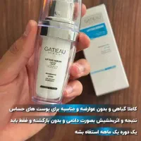 جوانسازی پوست درمان لک وچین وچروک|آرایشی، بهداشتی، درمانی|اشتهارد, |دیوار