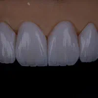 لابراتوار پروتزهای دندانی ثابت|پزشکی|نسیمشهر, |دیوار