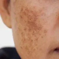 مشاور پوست مو وسلامتی